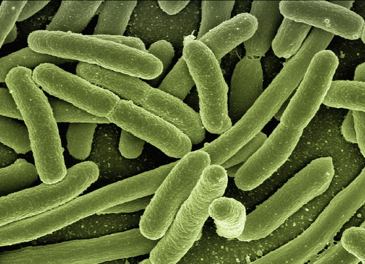 Foto: geralt / pixabay koli bacteria, escherichia coli, bacteria, disease, pathogens, microscopy, electron microscopy, electron microscope, vaccination, immune system, diseases, vaccine, escherichia, infect, infection, risk of infection, pathogen, viruses, bacteria, bacteria, bacteria, bacteria, bacteria